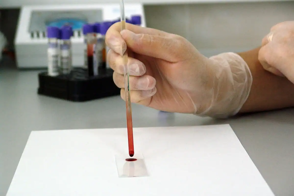 Pipetă cu probă de sânge așezată pe hârtie de test în laborator