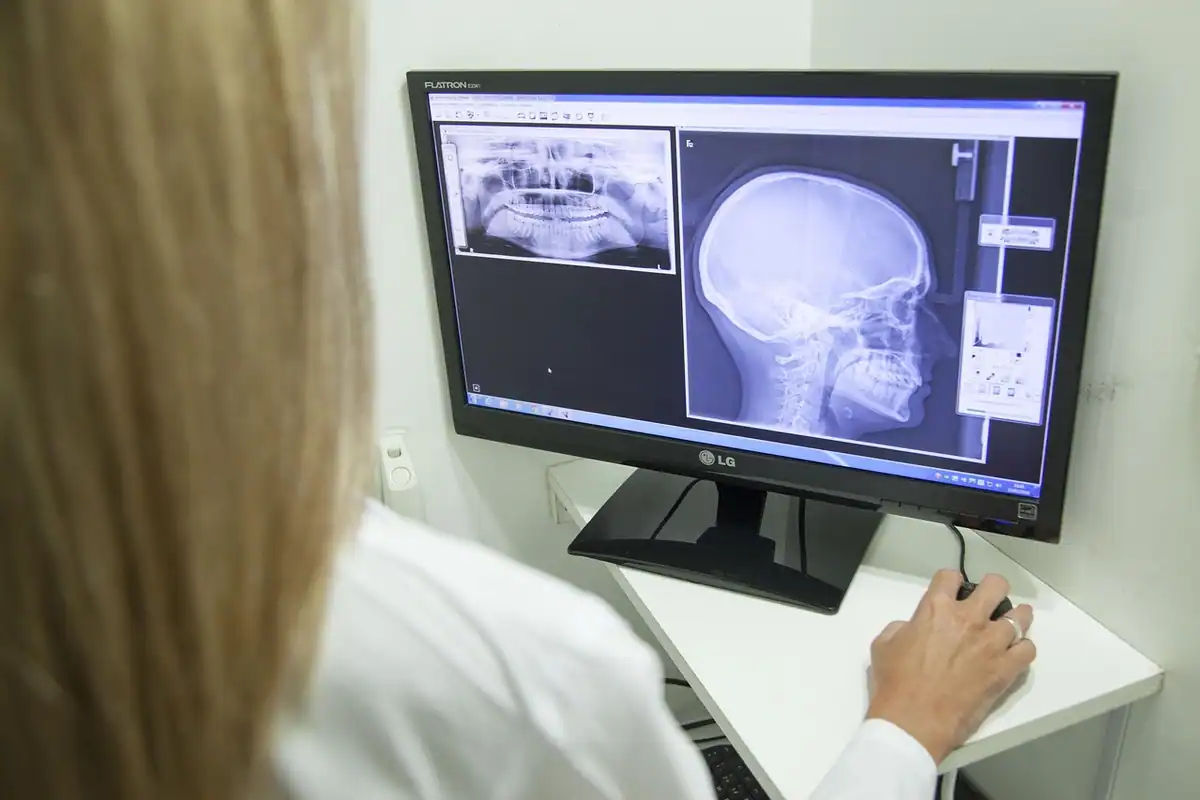 Radiolog studiază o radiografie a craniului pe monitorul din cabinet